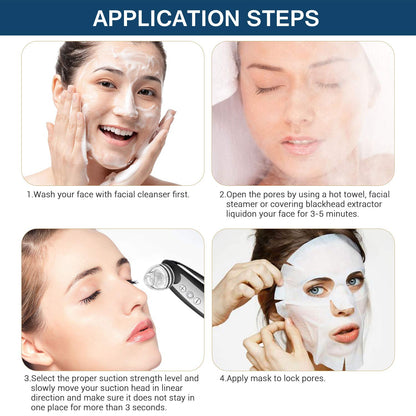 Blackhead Remover, TURATA Pore Cleanser Vacuum Kit (Black)